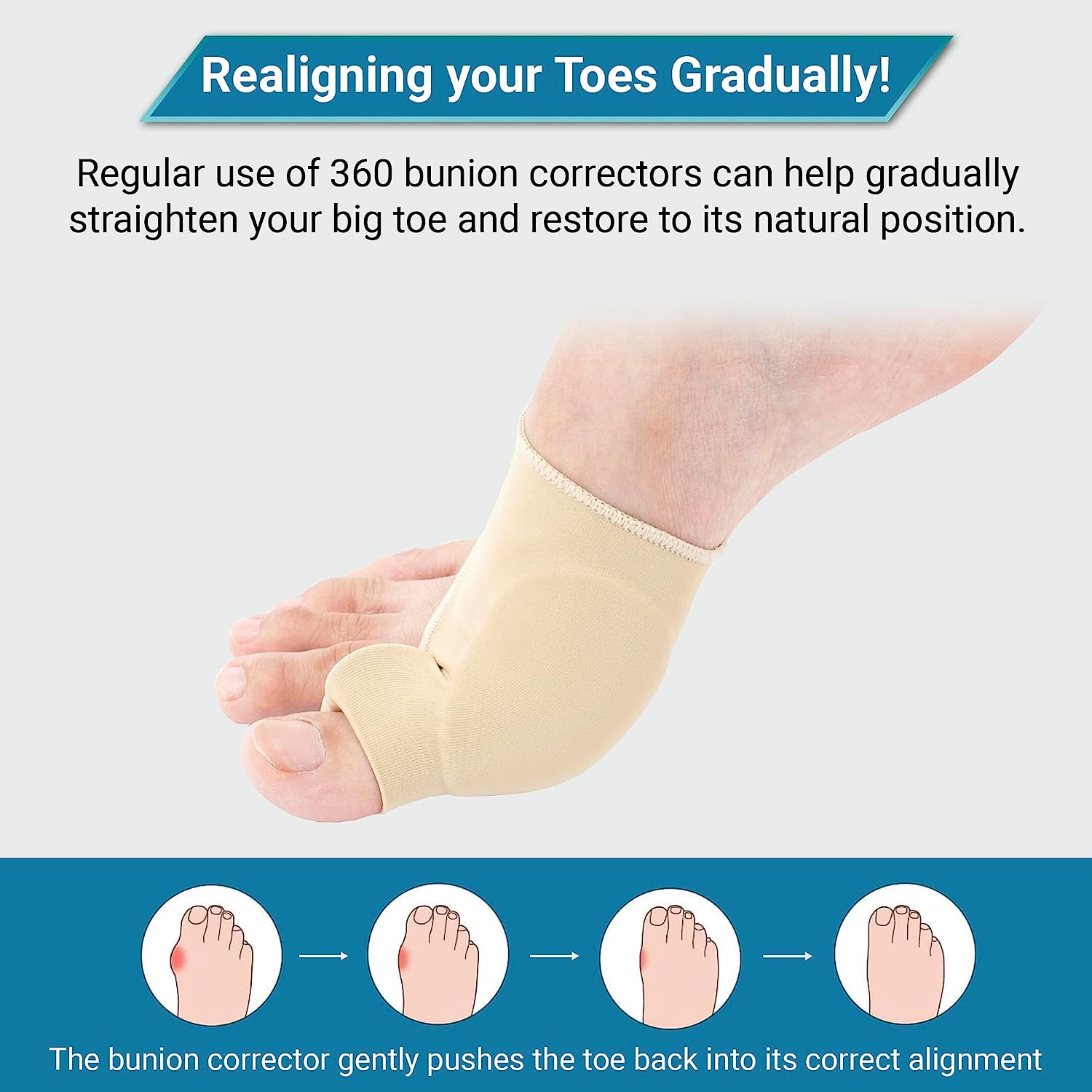 Aeroflux© Premium Bunion Corrector: 1 Pair (2 Correctors) DPD2