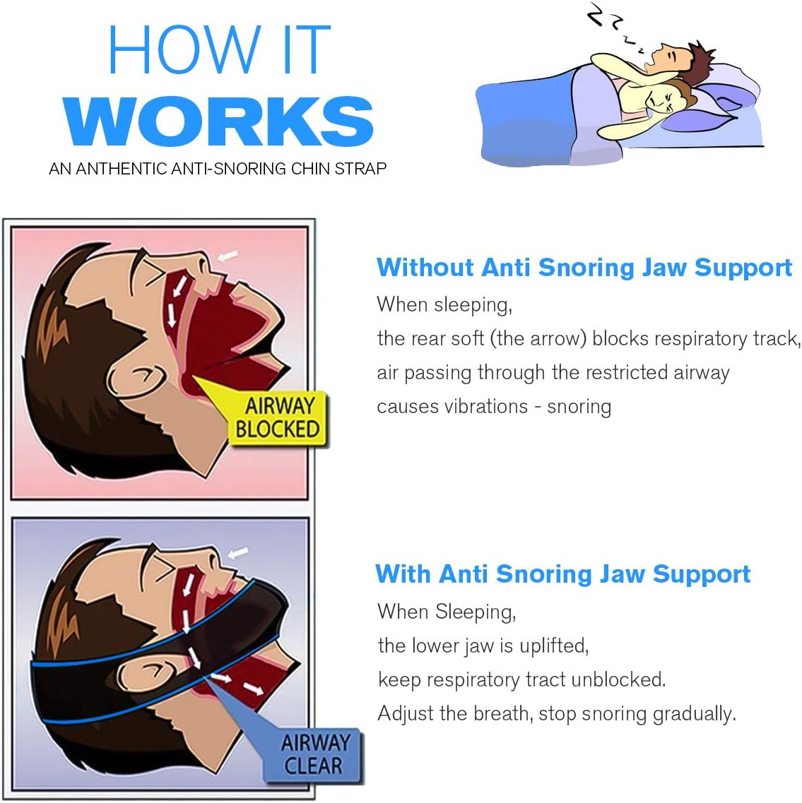 Aeroflux© MAGIC Snoring Strap: It 100% Works