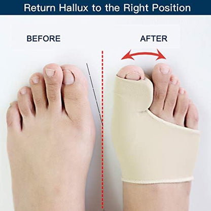 Aeroflux© Premium Bunion Corrector: 1 Pair (2 Correctors)