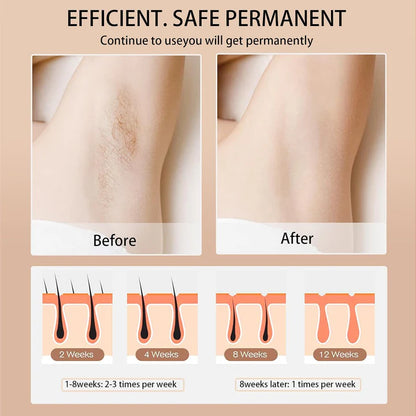 Aeroflux© Premium IPL Laser Hair Remover [Latest Technology + 1 Year Warranty]