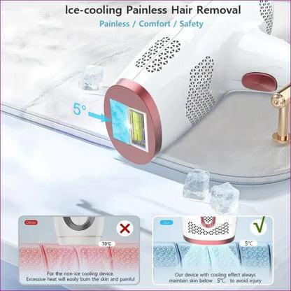 Aeroflux© Premium IPL Laser Hair Remover [Latest Technology + 1 Year Warranty]