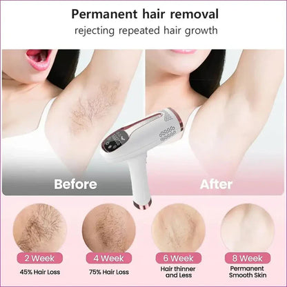 Aeroflux© Premium IPL Laser Hair Remover [Latest Technology + 1 Year Warranty]