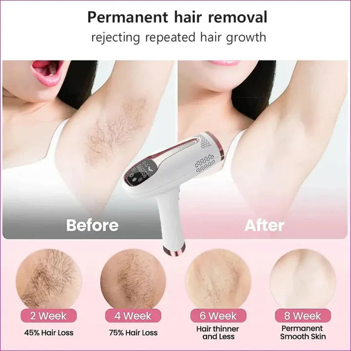 Aeroflux© Premium IPL Laser Hair Remover [Latest Technology + 1 Year Warranty]