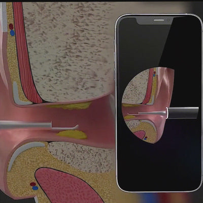 Aeroflux© XLife Smart Ear Cleaner Camera